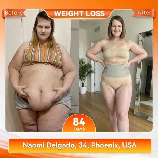 🥳2026 HOT SALE🥳💞80K+ SOLD!🌸🧘‍♀️ 40% OFF! Thermogenic Tummy Control Shorts – 30‑min daily wear, activates warmth & boosts circulation. Supports firmer, smoother contour. No gym needed. A smart shapewear choice. 👵✨