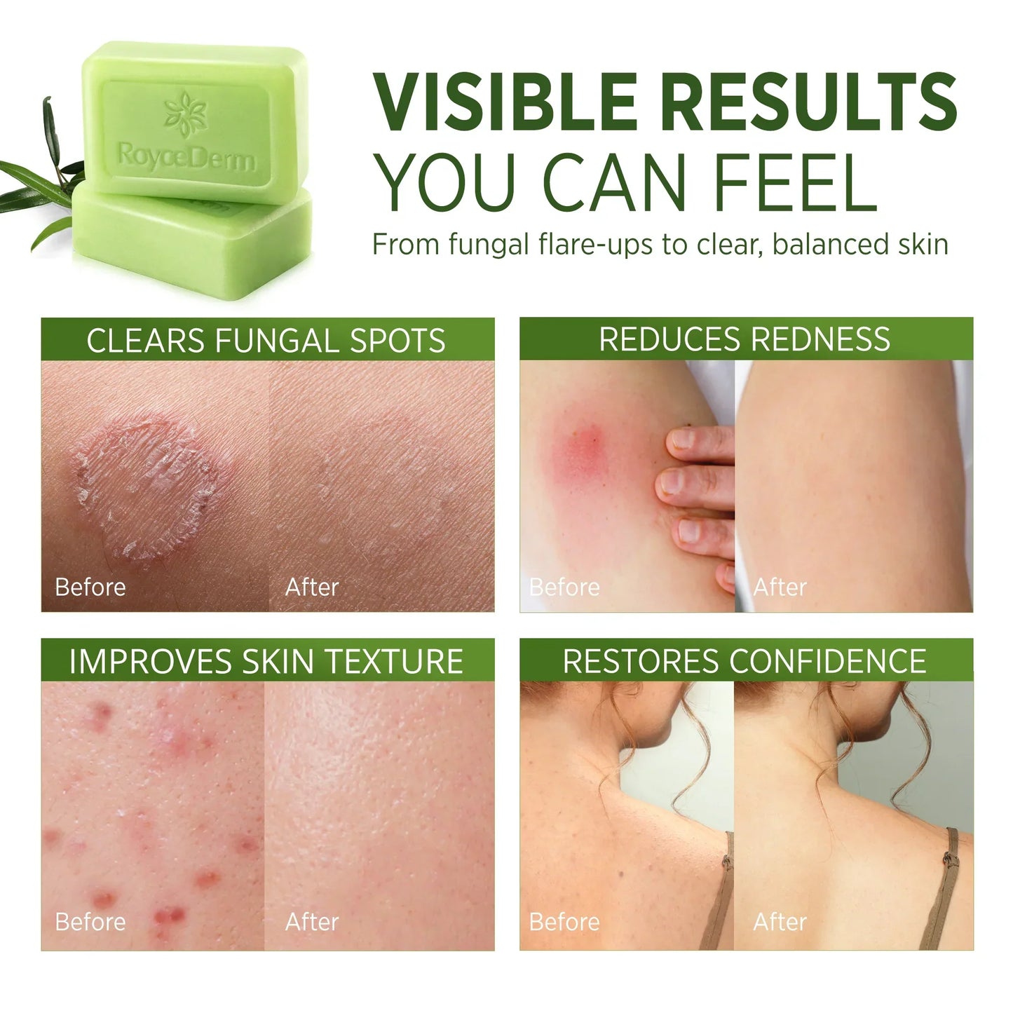 Tea Tree Oil Soap