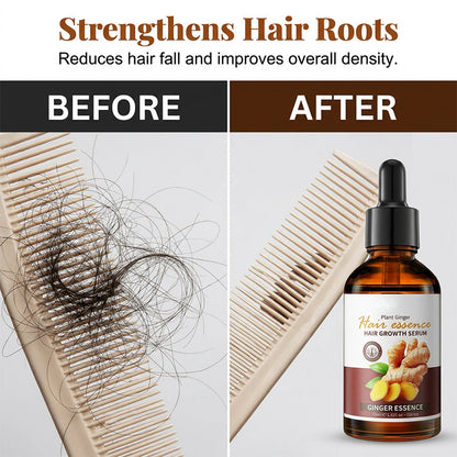 Ginger Anti-Hair Loss Treatment for Hair Growth