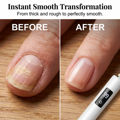 🥳Last Day Promotion!💅✨ Professional Electric Nail Polisher – Smooths thick nails, 99-speed display. Multiple heads for shaping & buffing. Salon at home! 🌟💎